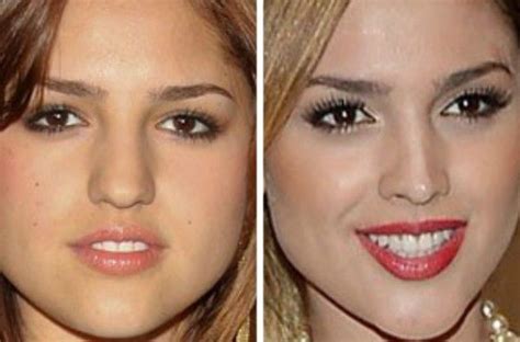 Eiza Gonzalez Nose Job What A Difference A Different Nose Makes