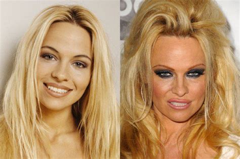 12 Celebs Who Are Unrecognizable After Plastic Surgery Celebrity