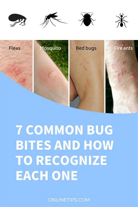 How To Identify Bed Bug Bites On Humans Wasaga Beach Break Fast Ca