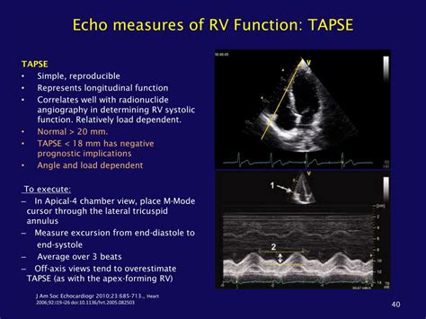 Ppt Role Of The Echocardiogram In The Assessment Of Pulmonary