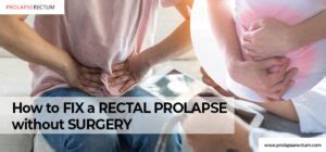How To Fix A Rectal Prolapse Without Surgery