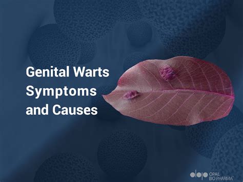 Genital Warts Symptoms And Causes Opalbiopharma