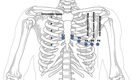 6 Precordial Electrodes Placement On The Thorax To Perform A Standard