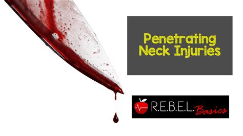 Penetrating Neck Injuries Rebel Em Emergency Medicine Blog