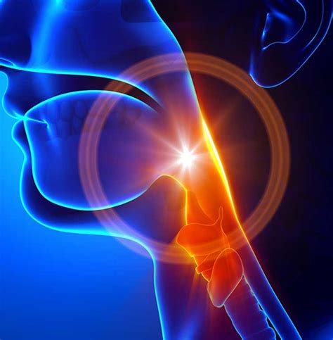 Vocal Cord Hemorrhage Uci Head And Neck Surgery Uci Ent Doctors
