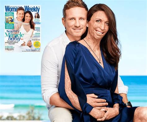 Turia Pitt And Michael Hoskin Love Story Is Inspiring Romantic Jodistory