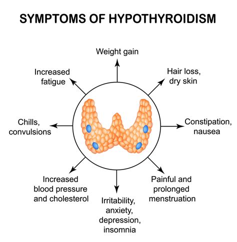 What Is Hypothyroidism Symptoms Causes Diagnosis Treatment And Hot