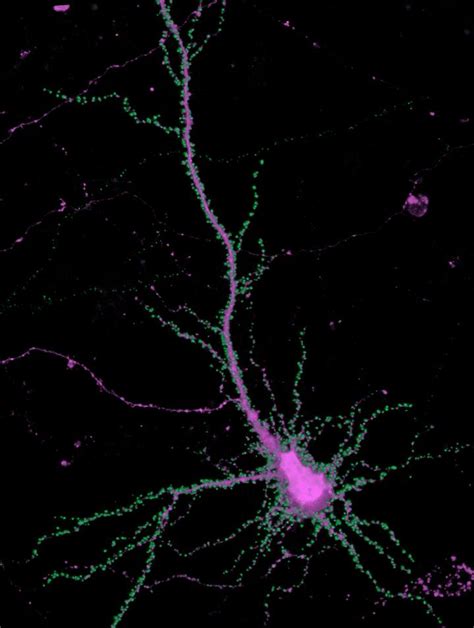 Syngap In A Hippocampal Neuron Image Eurekalert Science News Releases