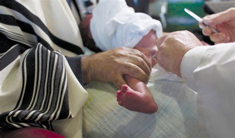Israeli Baby Requires Complex Surgery After Circumcision Gone Wrong