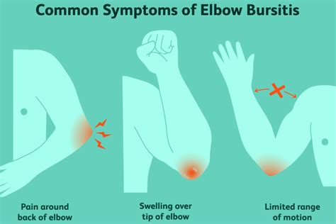 Think You Have Golfers Elbow Here Are The Symptoms And What You Can