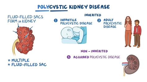 Polycystic Kidney Disease Pkd Nursing Osmosis Video Library