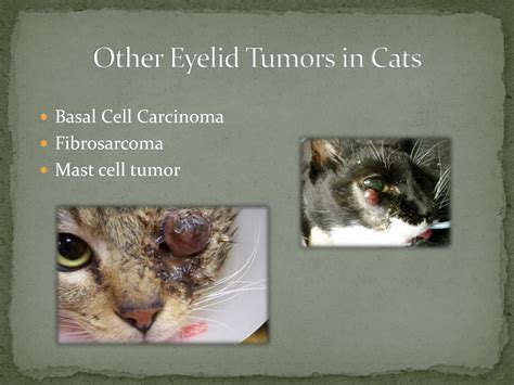 Ppt Eyelid Tumors Powerpoint Presentation Free Download Id2178485