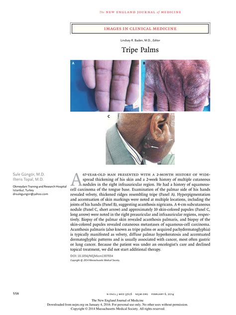 Pdf Images In Clinical Medicine Tripe Palms