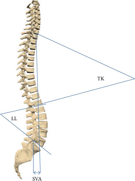 Figure 1 From Assessment Of Normal Sagittal Alignment Of The Spine And