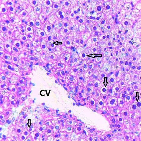 Photomicrograph Of Histological Structure Of Kidney Of A Control Mouse
