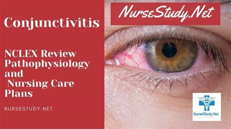 Conjunctivitis Nursing Care Plans And Diagnosis Interventions