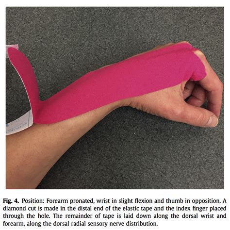 Two Ways To Tape The Wrist Rigid Tape And Kinesiology Tape
