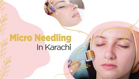 micro needling in karachi rejuve by aliya farooq