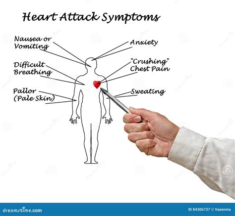 Heart Attack Symptoms Stock Image Image Of Body Infarction 84306737