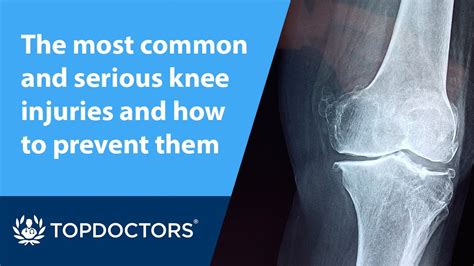 The Most Common And Serious Knee Injuries And How To Prevent Them Youtube
