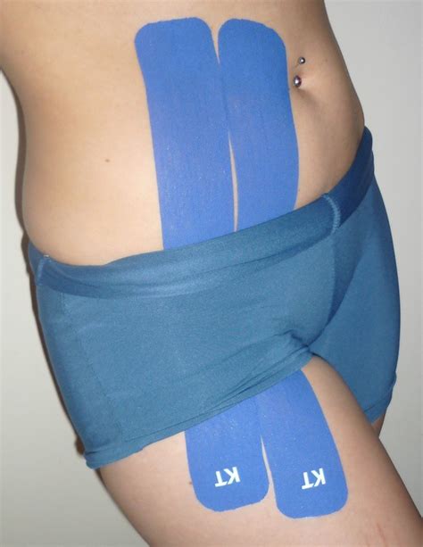 kt tape hip flexor application that hip joint likes to pop… flickr