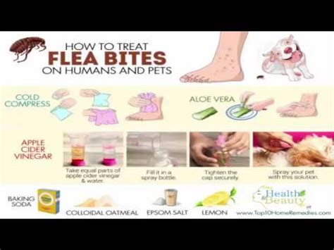 How To Treat Flea Bites On Humans And Pets YouTube