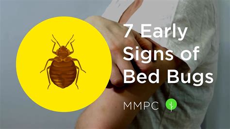 7 Early Signs Of Bed Bugs How To Know If You Have Bed Bugs Youtube