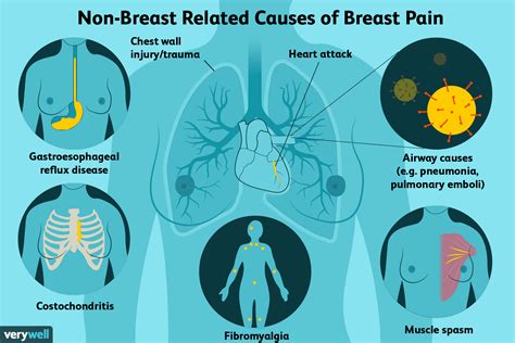 Possible Reasons Behind Your Breast Pain 2022