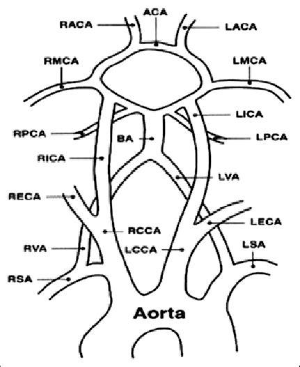 Vascular Anatomy Showing Common Carotid Artery Internal Carotid