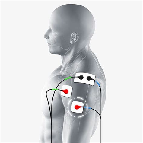 Calcific tendonitis is the calcification and tendon degeneration near the rotator cuff insertion, most commonly leading to shoulder pain with decreased range of motion. Deltoid Electrode Pad Placement | Image of Compex Electrode Placement for Deltoids | Tens unit ...