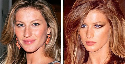 Gisele Bundchen Nose Job Plastic Surgery Before And After Celebie