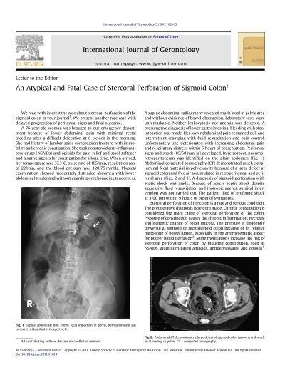 An Atypical And Fatal Case Of Stercoral Perforation Of Sigmoid Colon