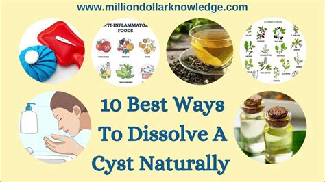 How To Get Rid Of Cysts Naturally Health Healthtips Healthcare Youtube