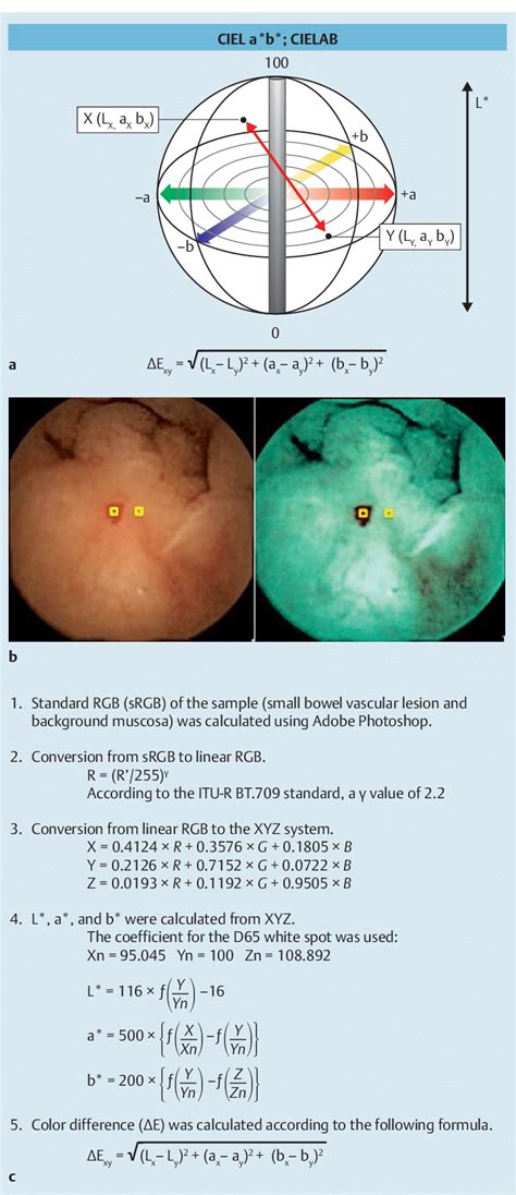 Colorimetric Evaluation Of Conventional Capsule Endoscopy Ce Images