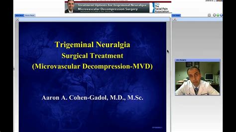 Microvascular Decompression Surgery For Trigeminal Neuralgia Youtube