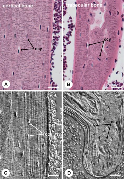 Histological Imaging Of Osteocytic Lacunarcanalicular System Using