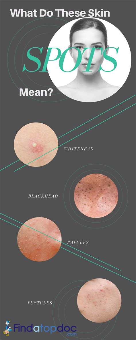 Red Spots On Skin Causes Diagnosis And Treatment Findatopdoc