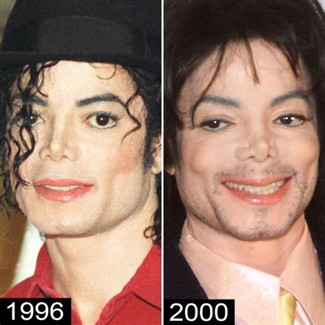 Michael Jacksons Plastic Surgery — See His Transformation