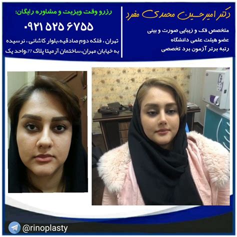 بهترین جراح بینی در تهران ، انتخاب بهترین جراح بینی دکتر امیرحسین