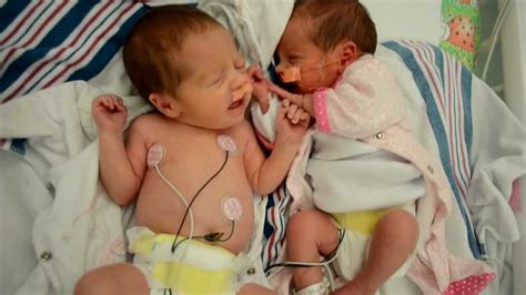 Premature Identical Twin Girls Sneezing Simaltaneously Youtube