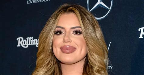 Brielle Biermann Says She’s ‘over The Big Lips’ Details