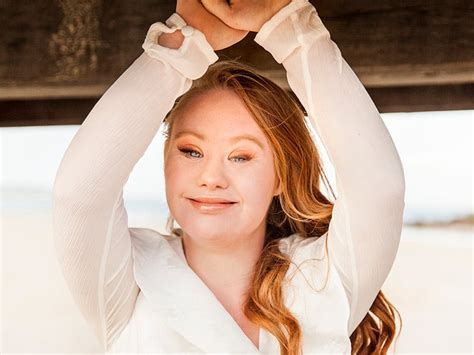 The Worlds First Supermodel With Down Syndrome Will Make You Want To Live Your Best Life