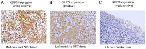 analysis of the grp78 expression in npc and chronic rhinitis tissues download scientific