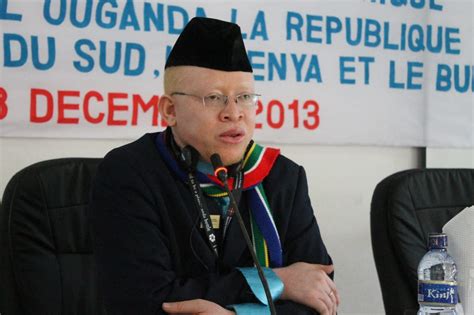 Top Successful Albinos In Africa
