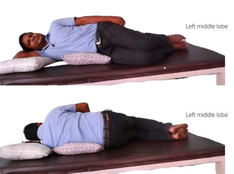 Easy Way To Remember Postural Drainage Positions Stark Dereter