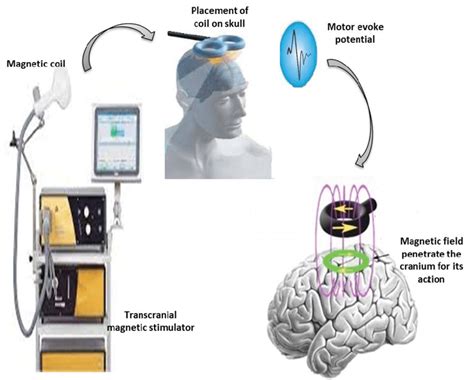 Process Of Transcranial Magnetic Stimulation Download Scientific Diagram