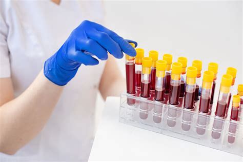 Can A Blood Test Detect Cancer Preventive Healthcare