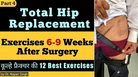 Top 12 Total Hip Replacement Exercises 6 7 8 9 Weeks After Surgery Hip