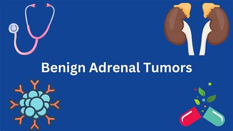 Benign Adrenal Tumors What You Need To Know Youtube