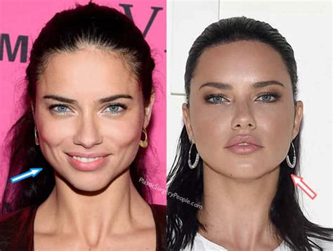 Did Adriana Lima Have Plastic Surgery Before And After 2020 2022